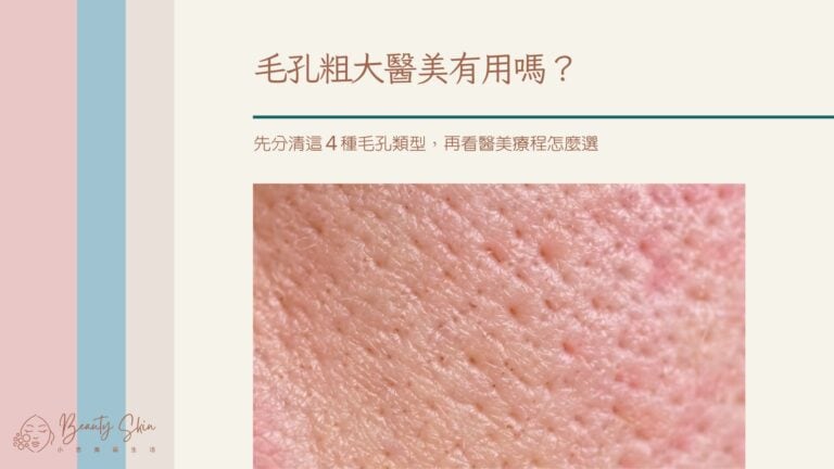 毛孔粗大醫美