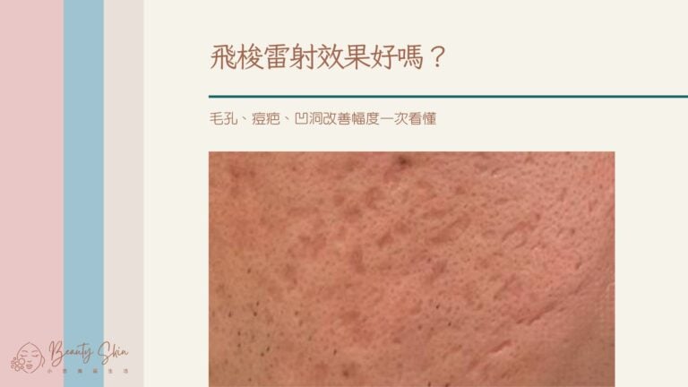 飛梭雷射效果