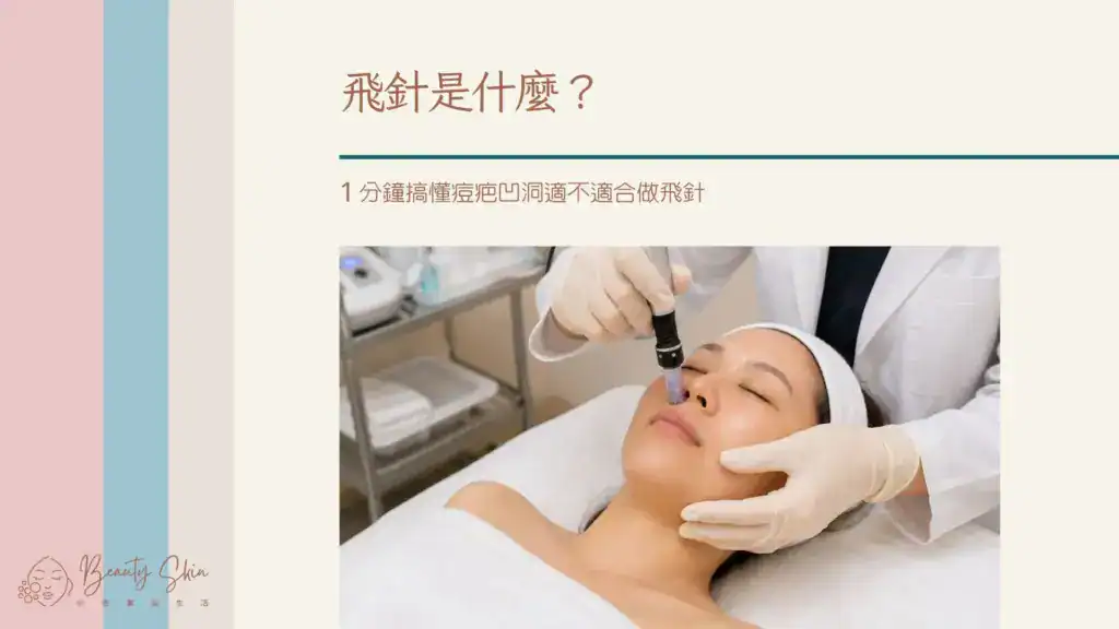 飛針是什麼？